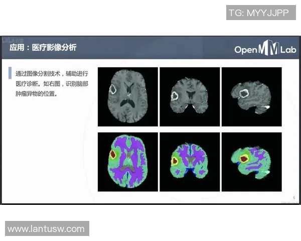 西安网球队整体压制战术解析与实战应用探讨